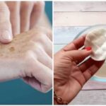Cum să reduci petele pigmentare cu un remediu natural simplu cf-featured-385