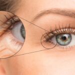 Cum să îngrijim pielea din jurul ochilor: soluții naturale pentru riduri fine cf-featured-486